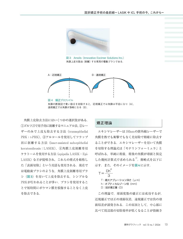 The LASIK最新屈折矯正手術の実際 Amazon.co.jp: 詳説近視レーザー手術: 最新屈折矯正手術LASIKの